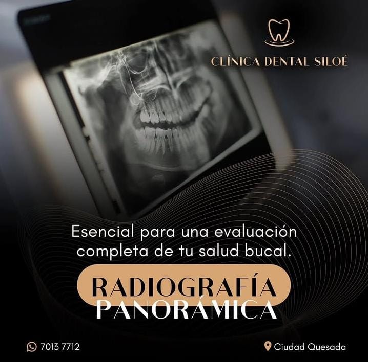 Publicación de radiografía panorámica de Clínica Dental Siloé