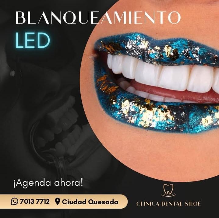 Publicación de blanqueamiento dental LED de Clínica Dental Siloé